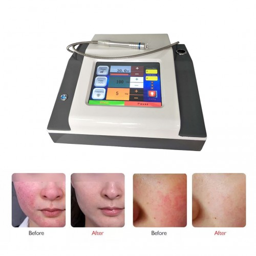 980nm Diode Laser Vascular Removal Machine for Doctors and Beauticians Use