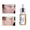 Centella Asiatica Desalinated Scar Anti Acne Serum