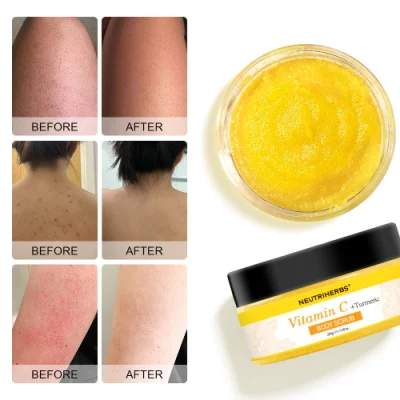 Private Label Skincare Acne-Prone Removal Chicken Skin Vitamin C Turmeric Body Scrub
