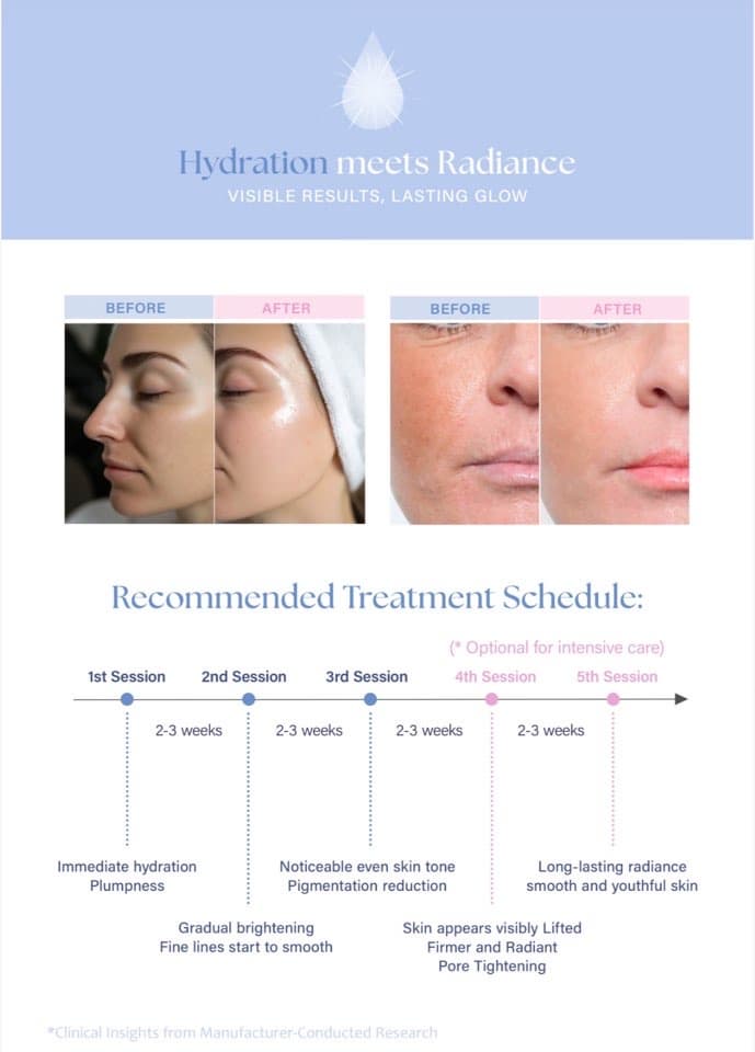 Rejuva Booster HA ,Glutathione Skin Booster Solution