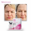 Hot Sale 100u 200u Anti Wrinkle Skin Care Botulax Botulium Toxin Type a