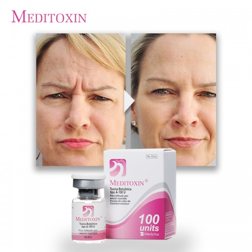 Wrinkle Removal toxin botulinum buy online