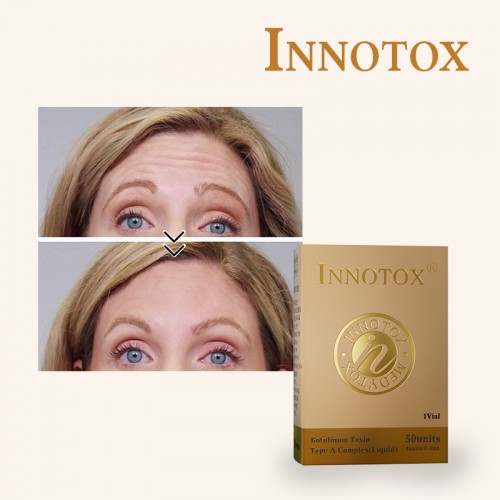 Hot Sale 100u 200u Anti Wrinkle Skin Care Botulax Botulium Toxin Type a