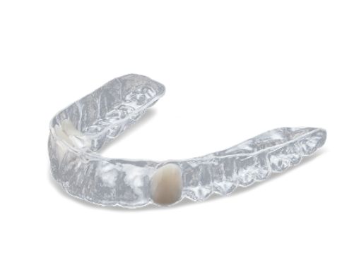 Essix Retainers