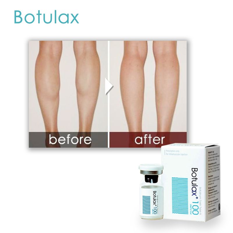 Hot Sale 100u 200u Anti Wrinkle Skin Care Botulax Botulium Toxin Type a