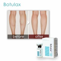 Hot Sale 100u 200u Anti Wrinkle Skin Care Botulax Botulium Toxin Type a