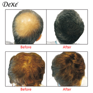 Hair Care Products New Branded Dexe Hair Grower Natural Hair