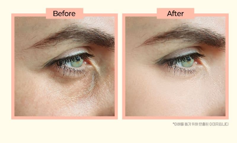 Vitamin C eye cream 