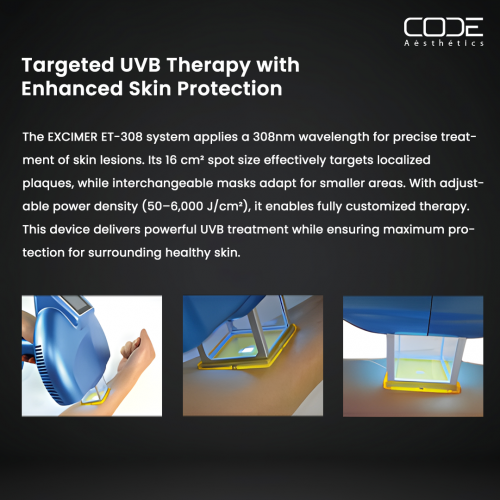 308nm Excimer UVB Light Therapy Device | Vitiligo & Psoriasis Treatment Machine | Handheld FDA Approved