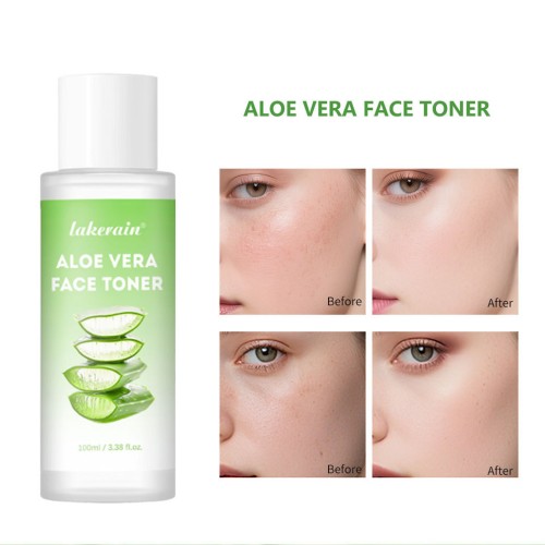 `Lakerain Aloe Vera Essence Toner, Moisturizing Refreshing Facial Makeup Water, Hydrating Aloe Toner for Face Daily Skin Treatment`