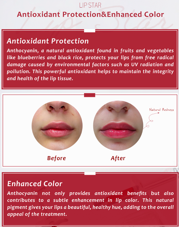 Lip Star 1.2ml  Lip Filler