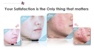Low MOQ Repair Acne and Sensitive Skin Taiwan Dermatologist brand Herbal Extract, Post Laser Skin Treatment Makeup Remover