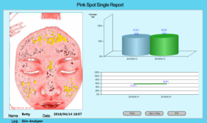 Portable skin scope analyzer/facial skin care equipment for clinic and spa