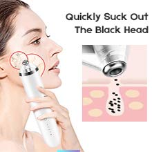 Rohs &CE Best Popular best anti aging skin care products new invention amazon top seller 2018 private label acne removal
