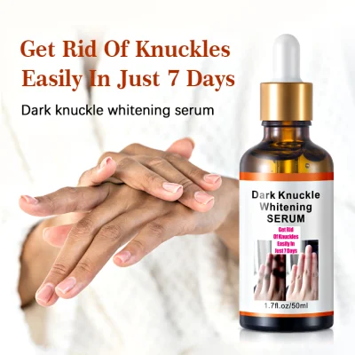 Mooyam Rapid Get Rid of Dark Hand Knuckle Whitening Serum Removing Dark Elbow Knees Clear Dark Knuckles Serum