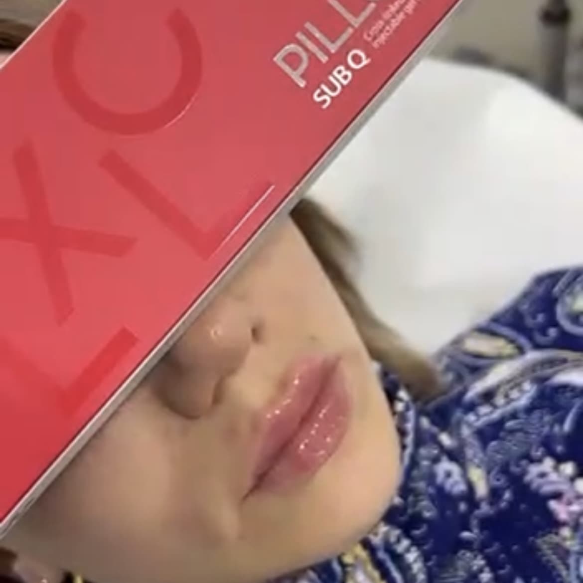 PILLOX HA Dermal Filler with CE