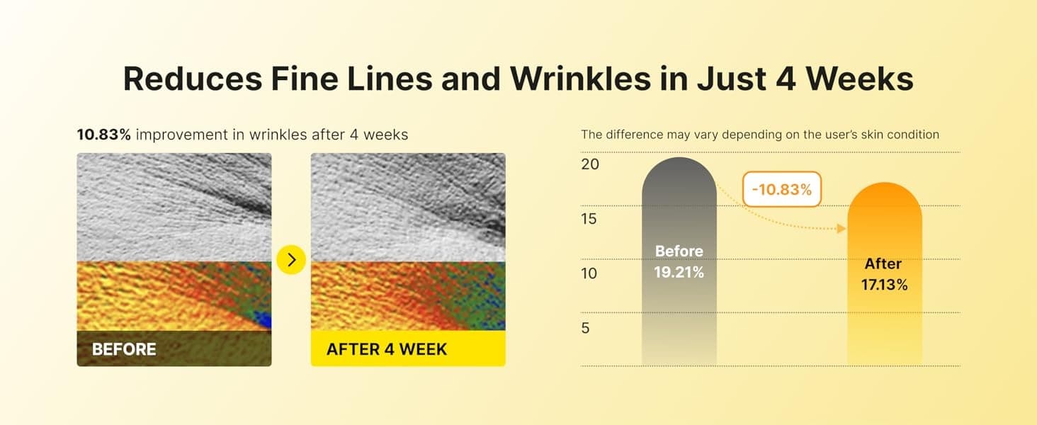 Retinal 0.1% Anti-Wrinkle LNP Cream