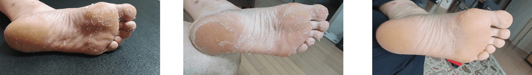 Silky Smooth Foot Peeling Mask 