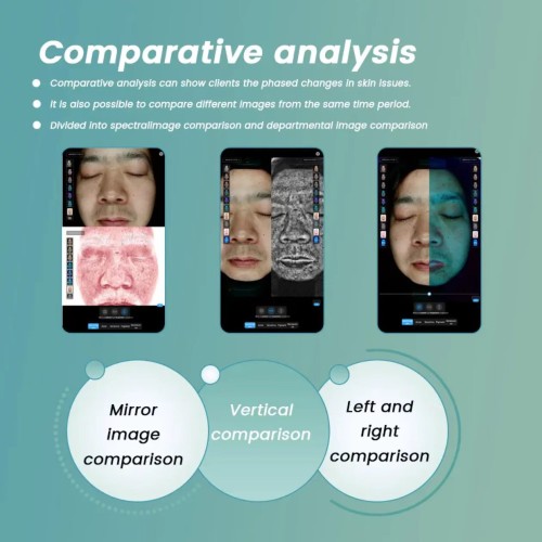 AI Facial Analysis Machine X5Pro 36 Million Pixels Skin Detector With Microscope Probe For Beauty Salon Skin Diagnosis