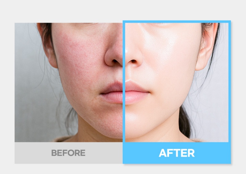 [MyHaelyn] Exosome B5 Advanced Repair 40ml a high-performance repair serum  repair support
