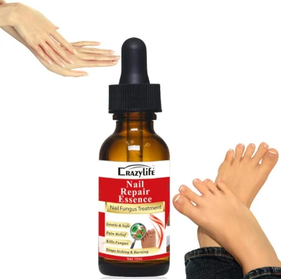 Spot Stock 10ml Effective Nail Repair Serum Essences Anti Fungus Remove Onychomycosis Toe Nourishing