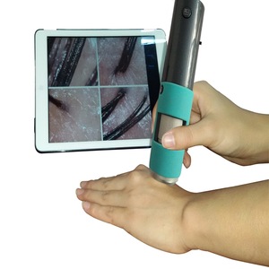 Suitable For A Variety Of System 600X Handheld Mini scalp Analyzer