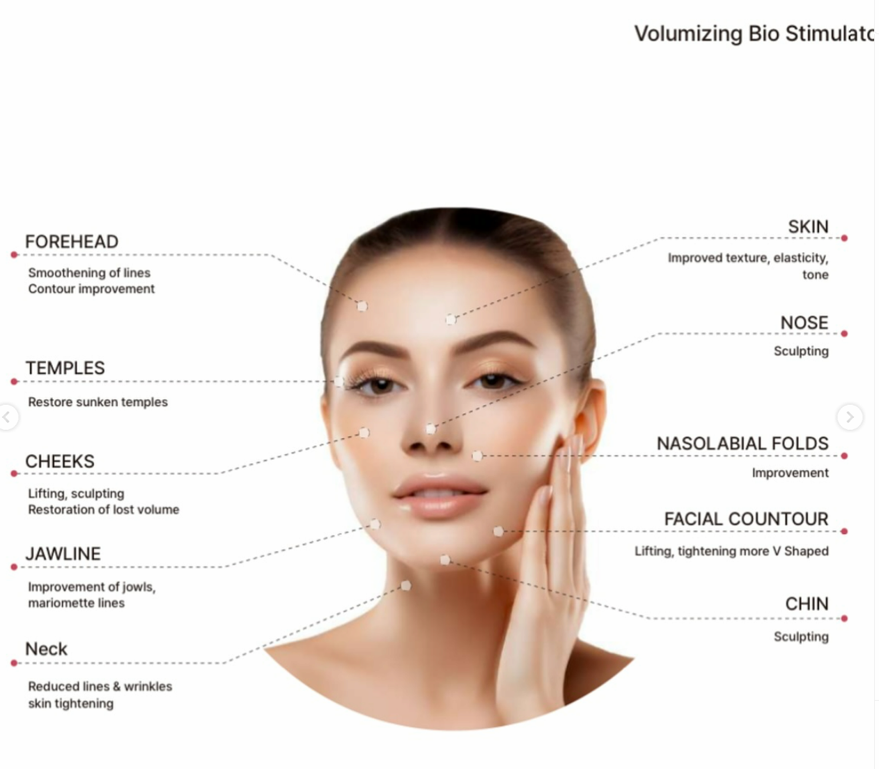 ULTRA CA+,  Volumizing Bio Stimulator, Calcium fillers