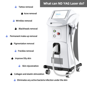 Carbon Peel Tattoo Removal Machine Q switched nd yag laser