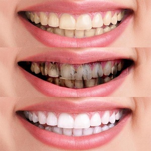 In stock Organic OEM Private Label Coconut Activated Charcoal Teeth Whitening Toothpaste