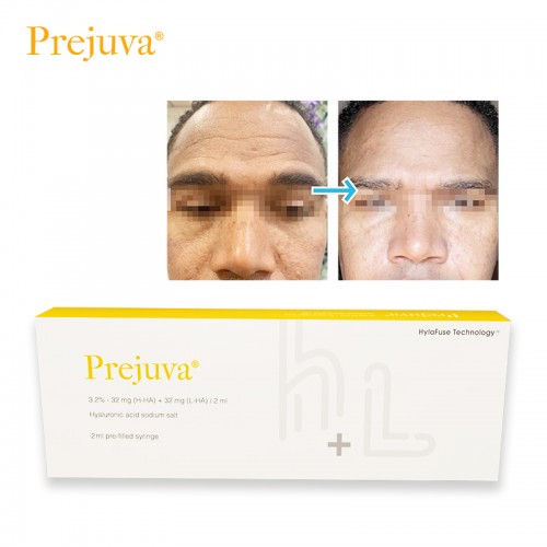 Prejuva Profhilo Skin Rejuvenecimiento Facial H-Ha and L-Ha 2ml Filler Buy Online