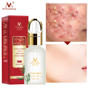 Acne removing essence serum Organic Skin Care Products Acne Scars Bio Essence Scar Removal EGF Serum