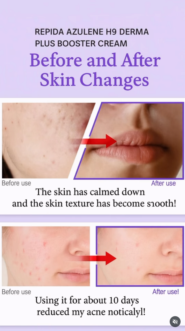 Azulene H9 Derma Plus Booster Cream 