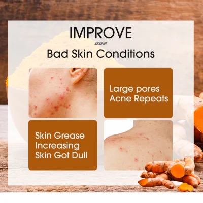 New Product Brightening Face Acne Clearing Men Best Seller Organic Bar Handmade Whitening Soap for Black Skin