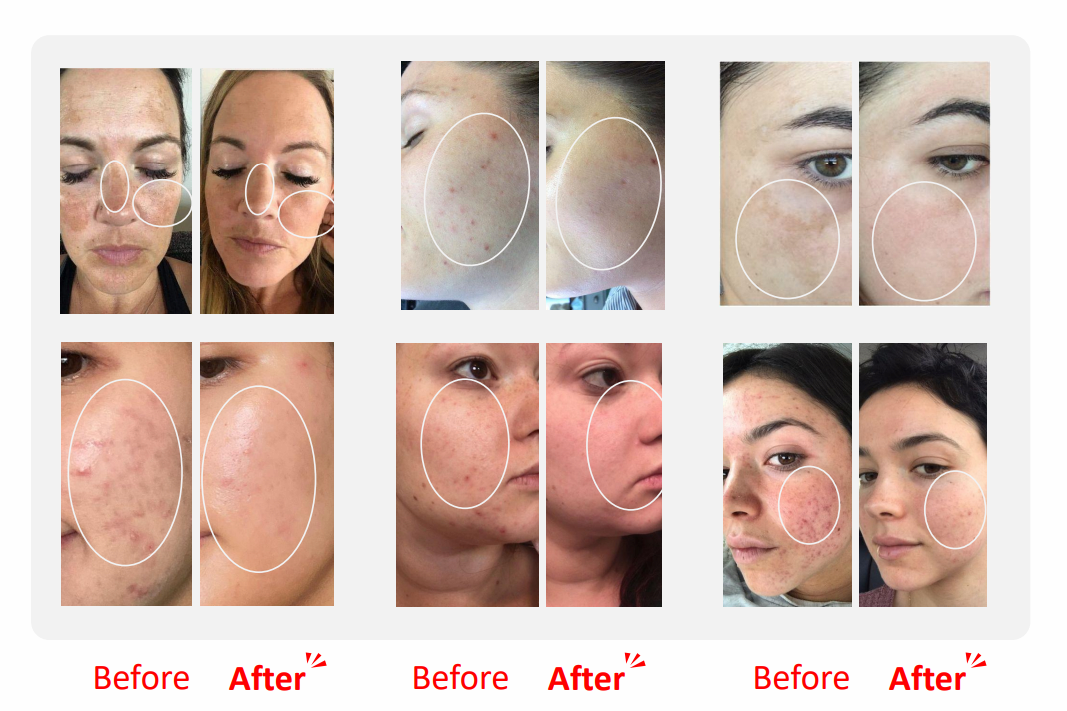 VELATOX Premium Skin Booster with 11 Cell Growth Factors