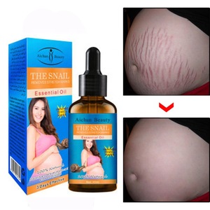 Aichun Beauty body repair 100% Natural The snail Scar Removal Fast removes Stretch Mark Essential Oil
