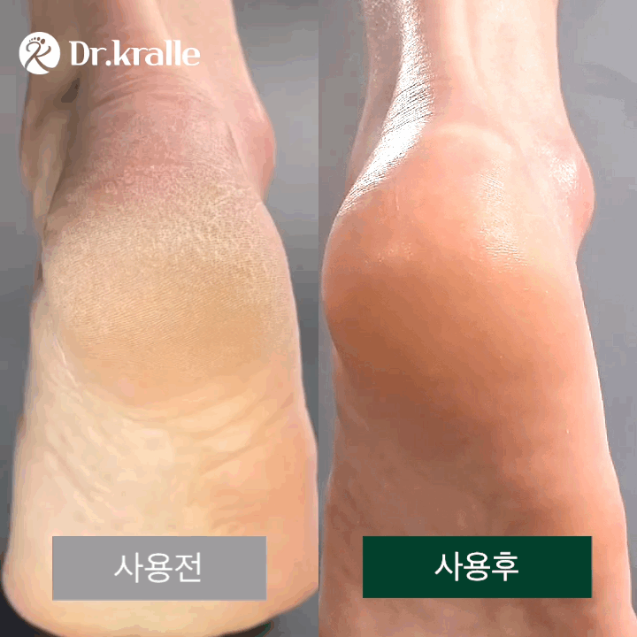 Dr. Kralle 3-Piece Foot Exfoliator Kit, foot care, foot scrub, exfoliate, home care, easy care