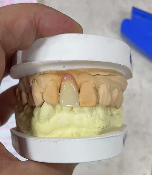 China Outsourcing Dental Lab, Dental Lab Chinese