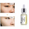 Private Label Whitening Serum Yeast Brightening Skin Tone Serum