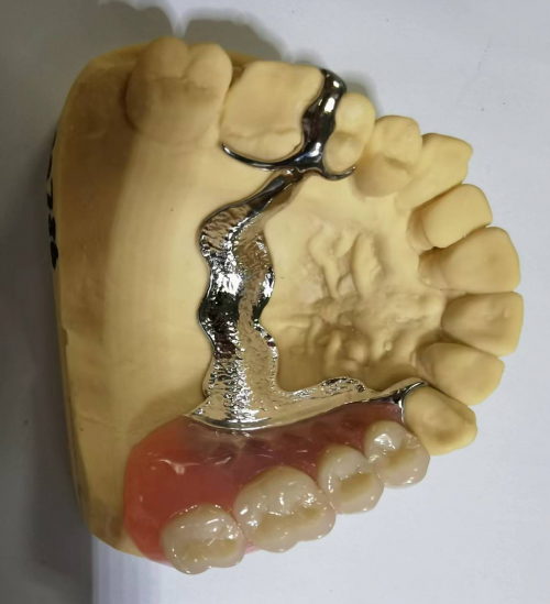 China Outsourcing Dental Lab, Dental Lab Chinese