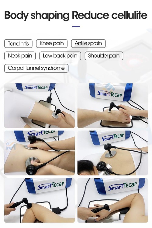 smart tecar