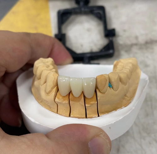 China Outsourcing Dental Lab, Dental Lab Chinese