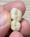 China Outsourcing Dental Lab, Dental Lab Chinese