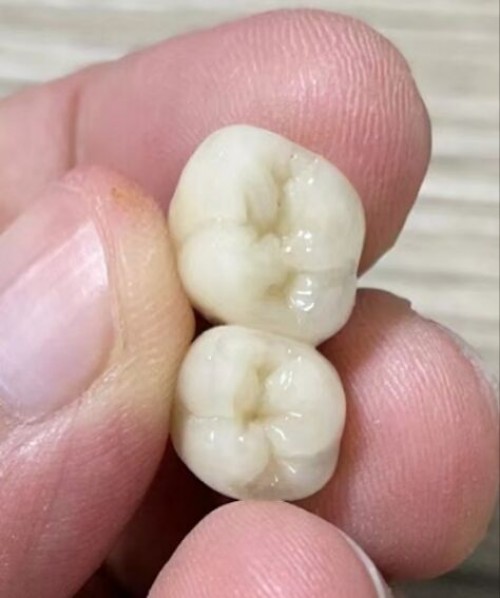 China Outsourcing Dental Lab, Dental Lab Chinese