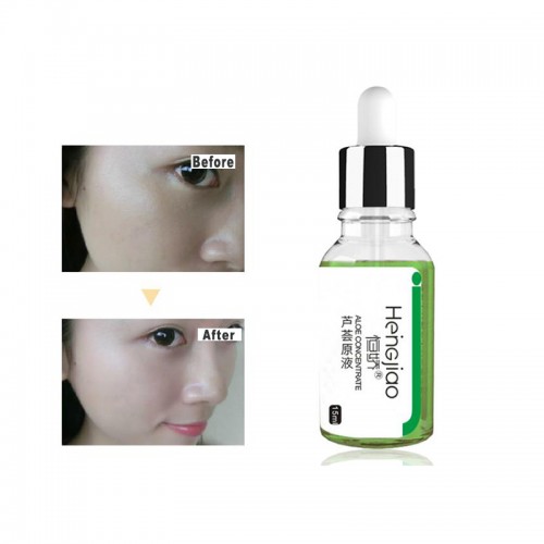 Aloe Vera Moisturizing Oil Balance Concentrate Serum