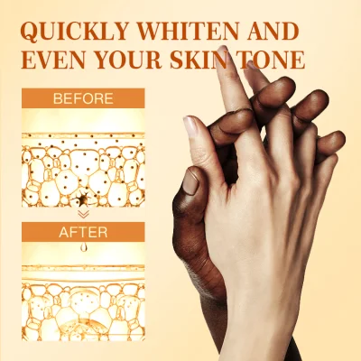 Mooyam Rapid Get Rid of Dark Hand Knuckle Whitening Serum Removing Dark Elbow Knees Clear Dark Knuckles Serum