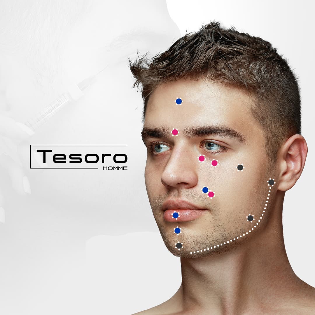 Tesoro Homme filler