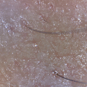 AYJ-J011 micro camera skin and hair skin moisture analyzer device
