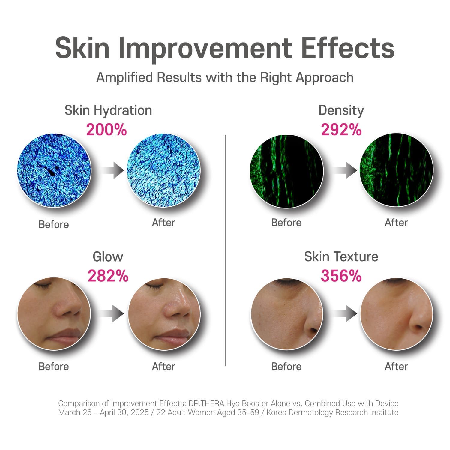 Dr. Thera-Duo Stainless Steel ABS Handheld RF Ultrasonic Beauty Device Tightening Daily Skincare