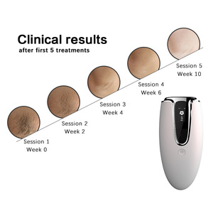 How long does laser hair removal take top ipl machines facial systems home