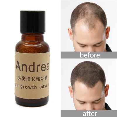 Fast Hair Growth Pilatory 20 Ml Essence Hair Oil